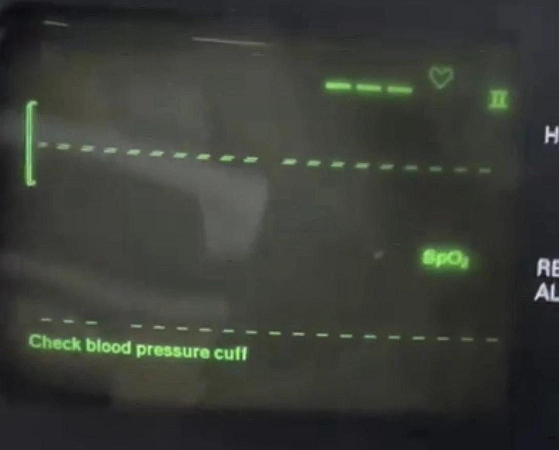 Used CPT MI0518P43AU1 5" CRT W/ Pemstar 620010-501 Board, TY929001 Deflection Yoke