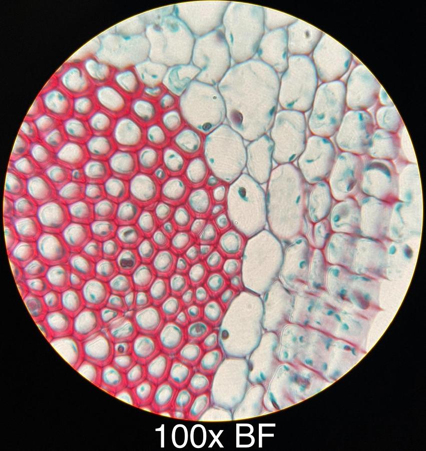 Used Motic BA400 Trinocular Phase Contrast Microscope W/ Plan 10/20/40/100 Objectives