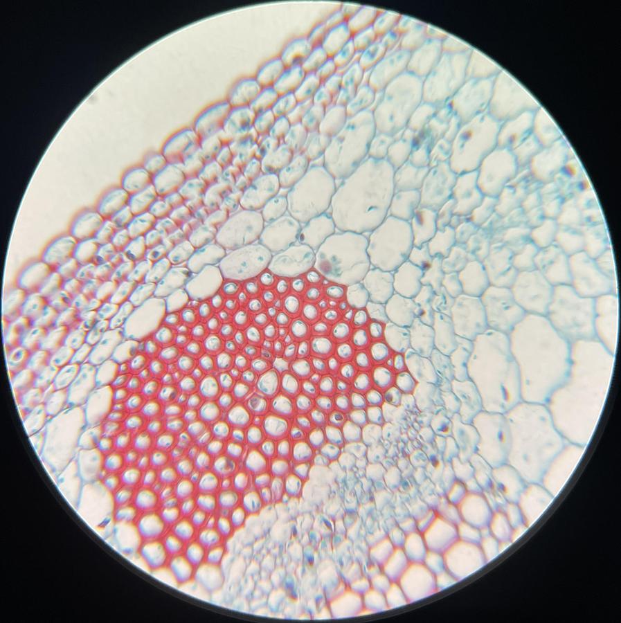 Used Zeiss 440351 Plan-NEOFLUAR Ph2 40x/0.75 Infinity/0.17 Microscope Objective