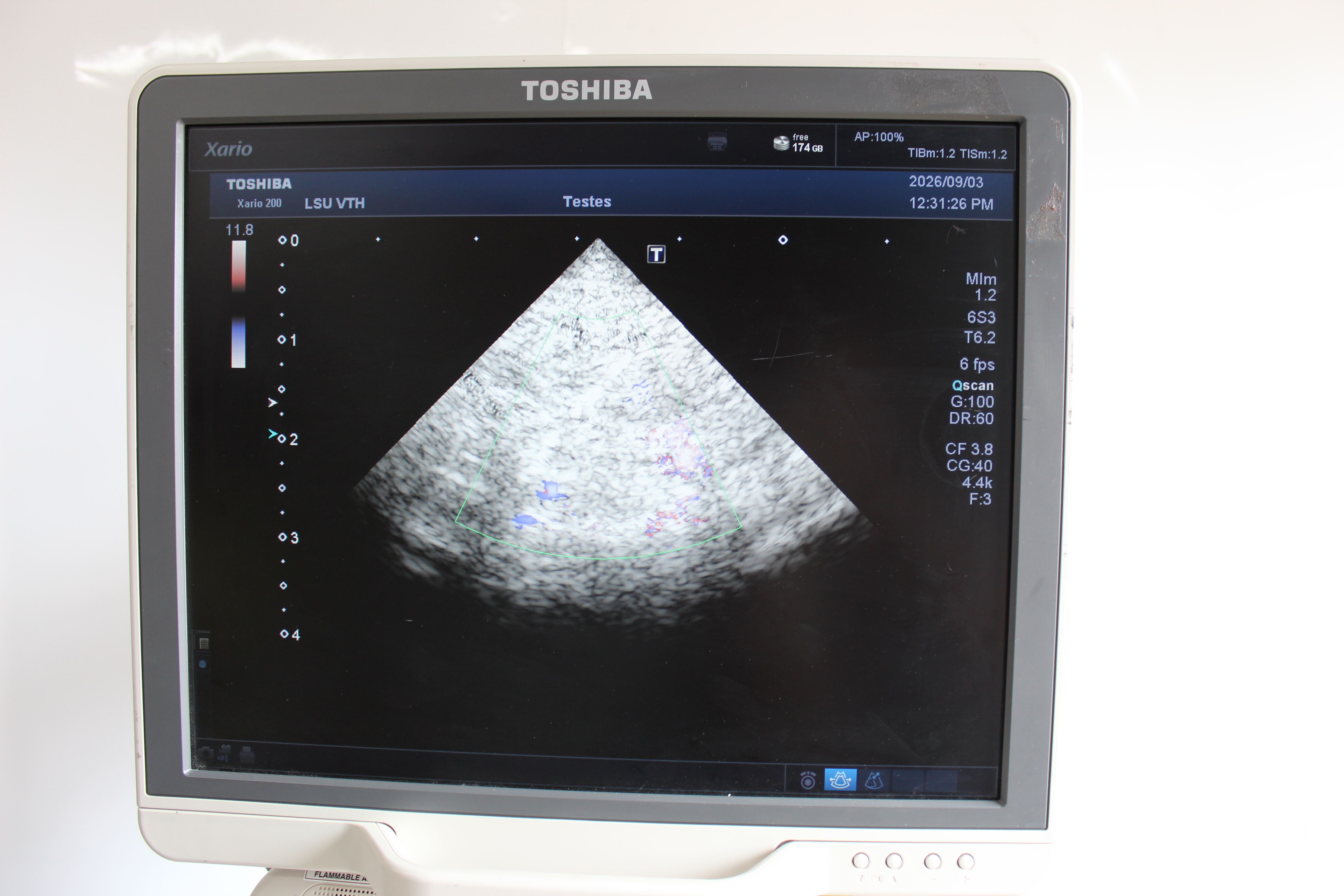 Used Toshiba Xario 200 Ultrasound TUS-X200 w/ 6S3 + 18L7 Probes