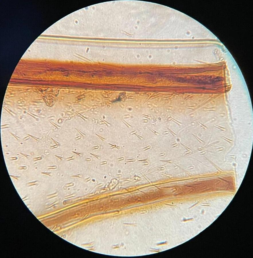 Used Olympus A 40 PL 1-LP150 Objective (A 40 PL 0.65 160/0.17)