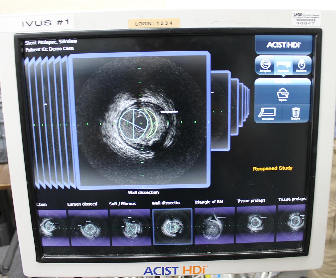 Used ACIST HDi System Console REF 017987
