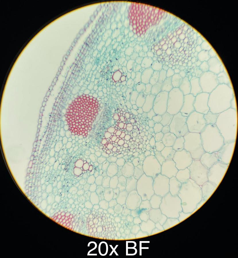 Used Motic BA400 Trinocular Phase Contrast Microscope W/ Plan 10/20/40/100 Objectives
