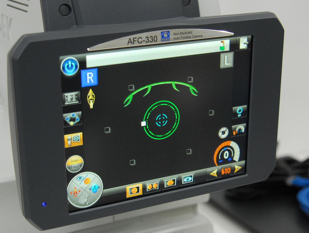 Used Nidek AFC-330 Non-Mydriatic Auto Fundus Camera W/ Case, Software, Laptop