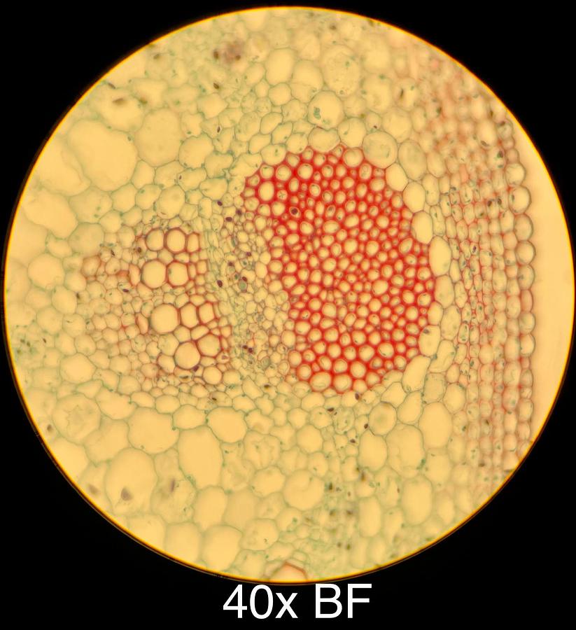 Used Motic BA400 Trinocular Phase Contrast Microscope W/ Plan 10/20/40/100 Objectives