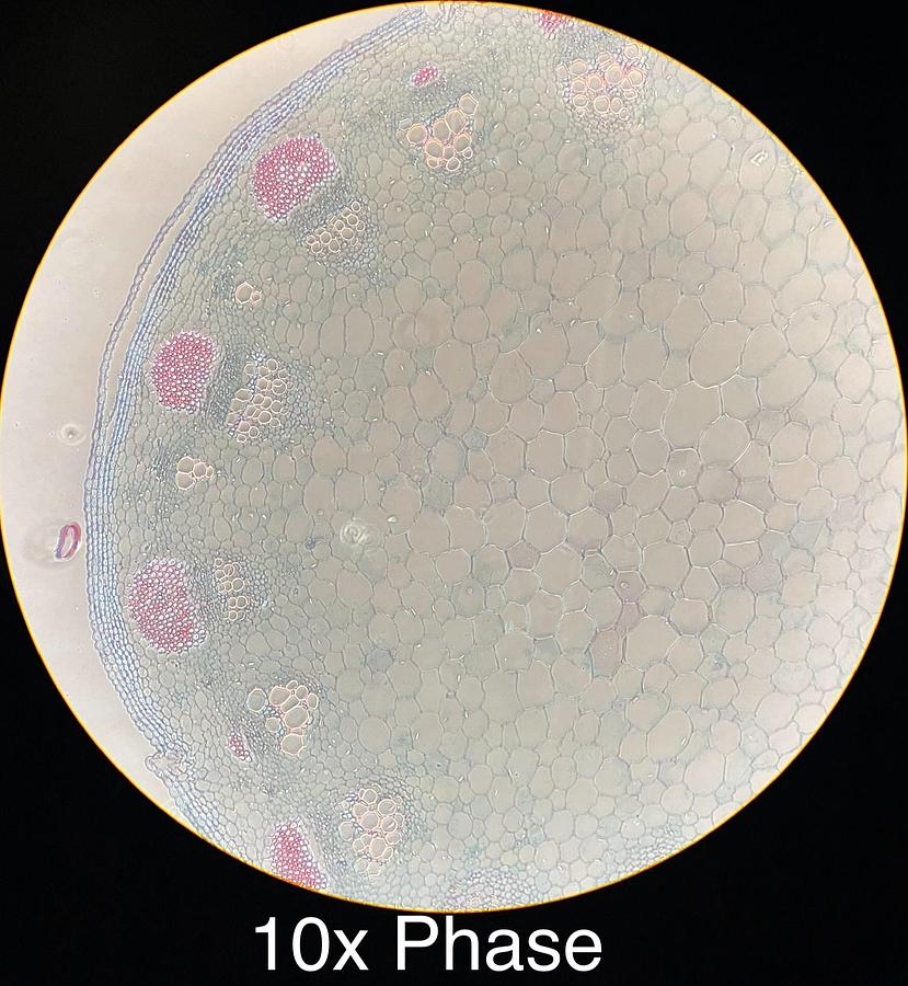 Used Motic BA400 Trinocular Phase Contrast Microscope W/ Plan 10/20/40/100 Objectives