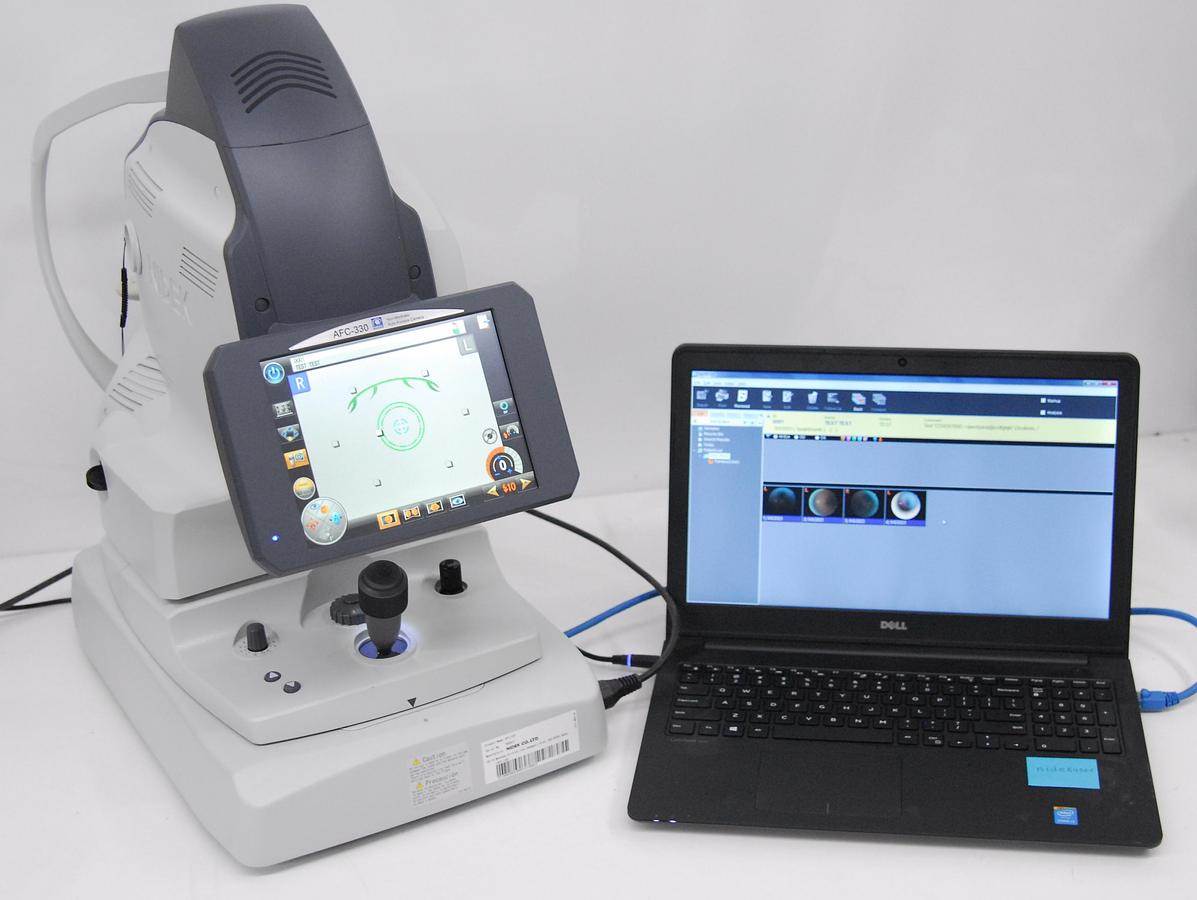 Used Nidek AFC-330 Non-Mydriatic Auto Fundus Camera W/ Case, Software, Laptop