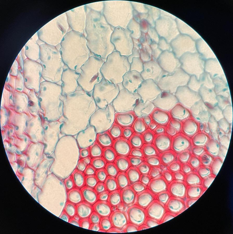 Used Olympus Ach 100x/1.25 Oil Iris ∞/- Infinity Microscope Objective