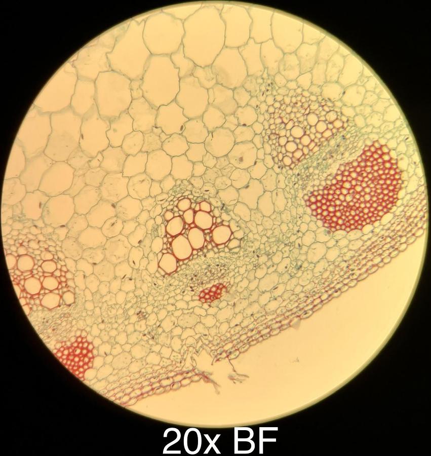 Used Motic BA400 Trinocular Phase Contrast Microscope W/ 4/10/20/40/100 Objectives