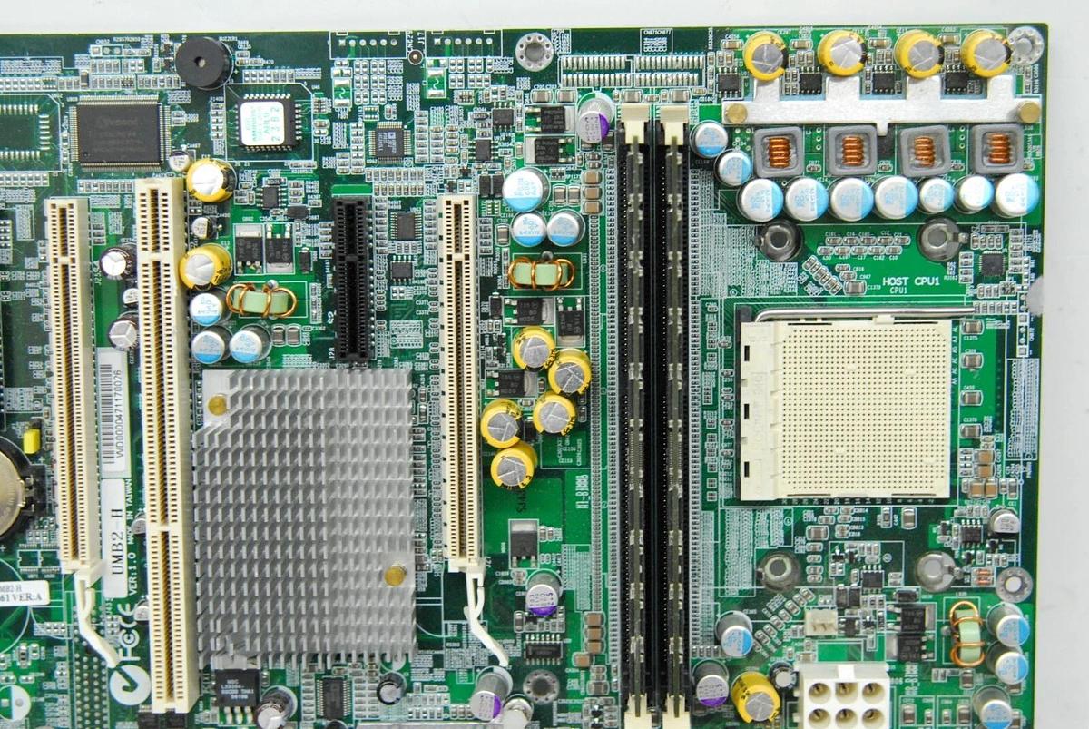 Used Philips 453561312461 UMB2-H Motherboard (iU22/iE33 Ultrasound)