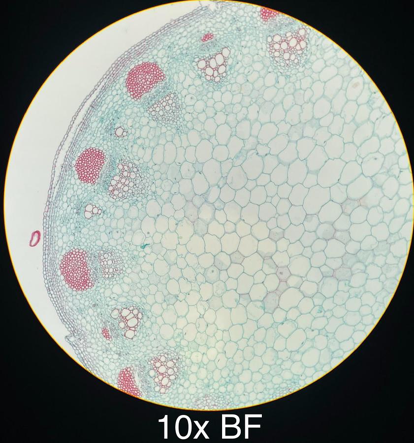 Used Motic BA400 Trinocular Phase Contrast Microscope W/ Plan 10/20/40/100 Objectives