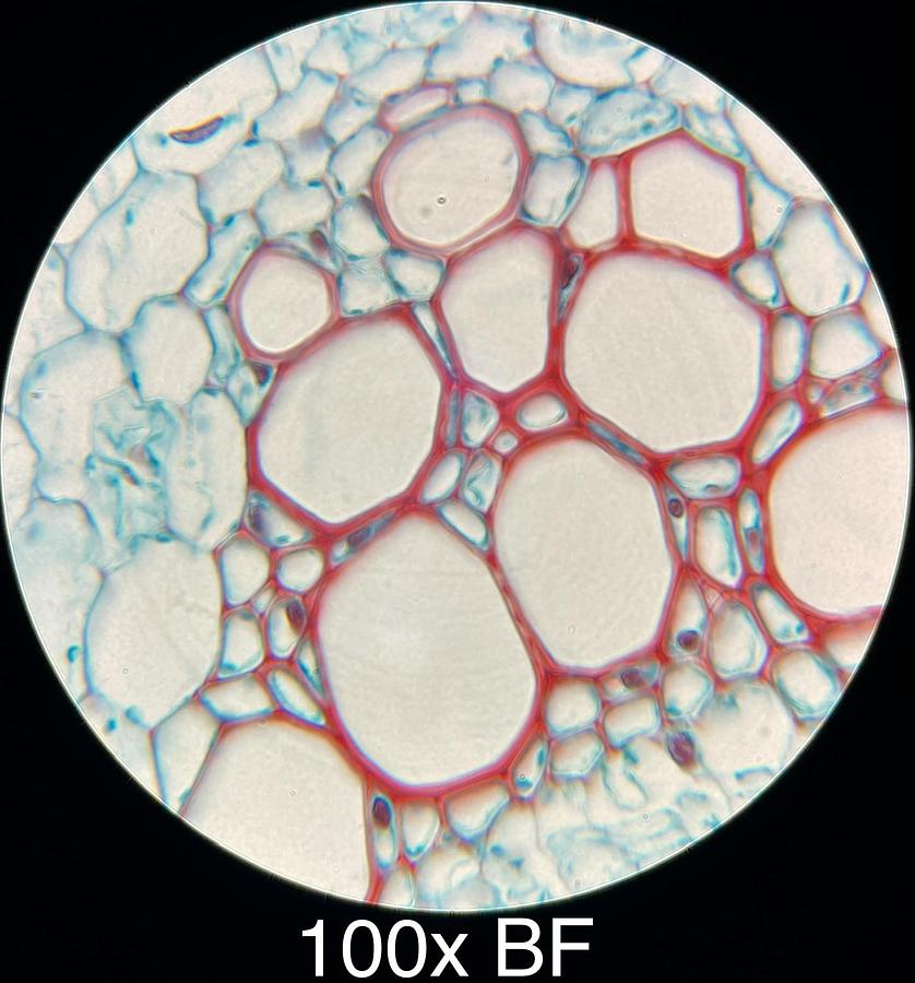 Used Motic BA400 Trinocular Phase Contrast Microscope W/ 4/10/20/40/100 Objectives