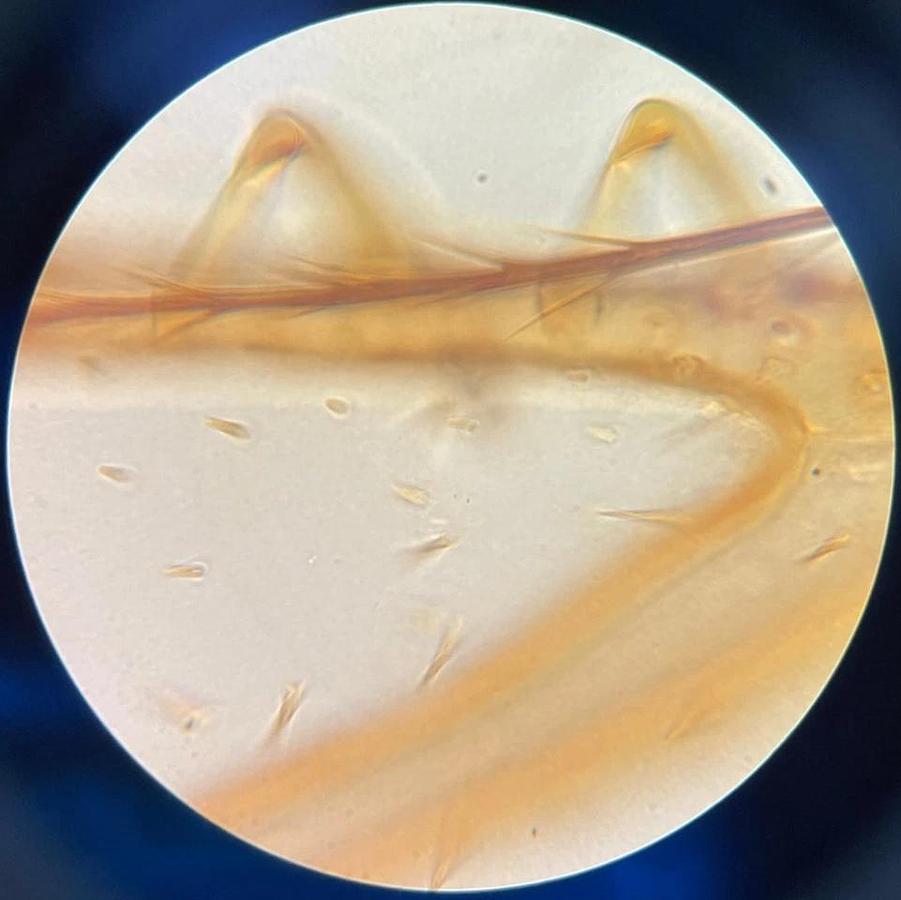 Used Zeiss 46 19 10-9902 Plan 100/1.25 Oel 160/- Objective (100x Oil)