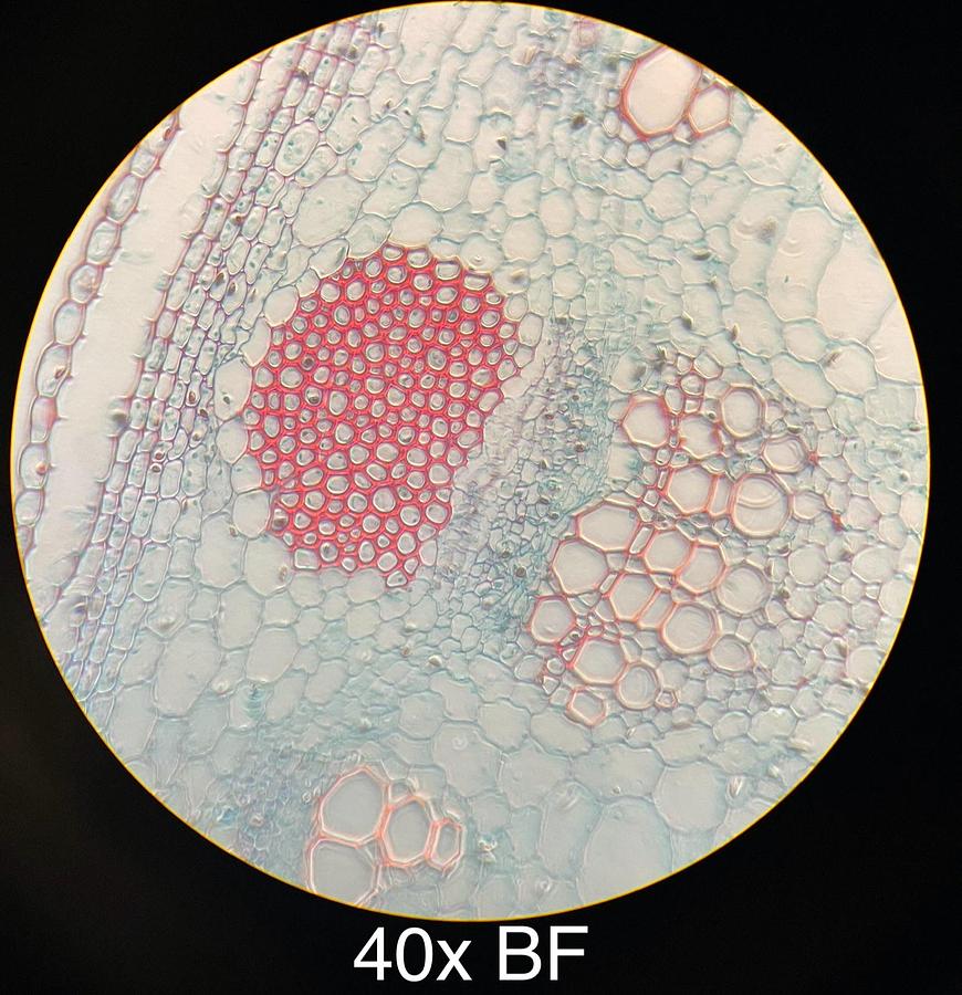 Used Motic BA400 Trinocular Phase Contrast Microscope W/ Plan 10/20/40/100 Objectives