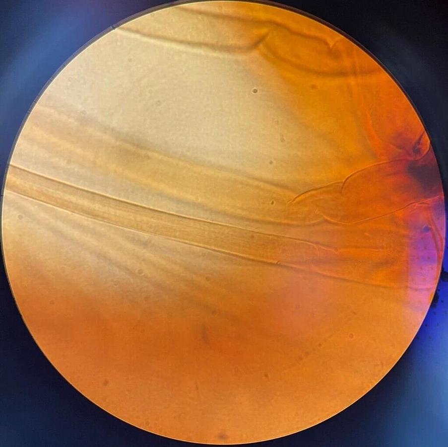 Used Leica PL 100Ph/1.25 Oil ∞/0.17 (1753) Phase Planachromat Microscope Objective