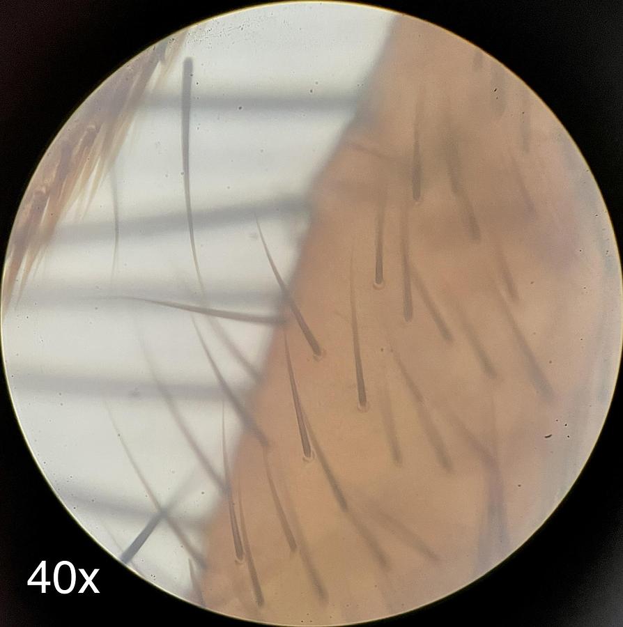 Used Fisher Scientific Micromaster Model E Microscope W/ 4/10/40/100x Objectives