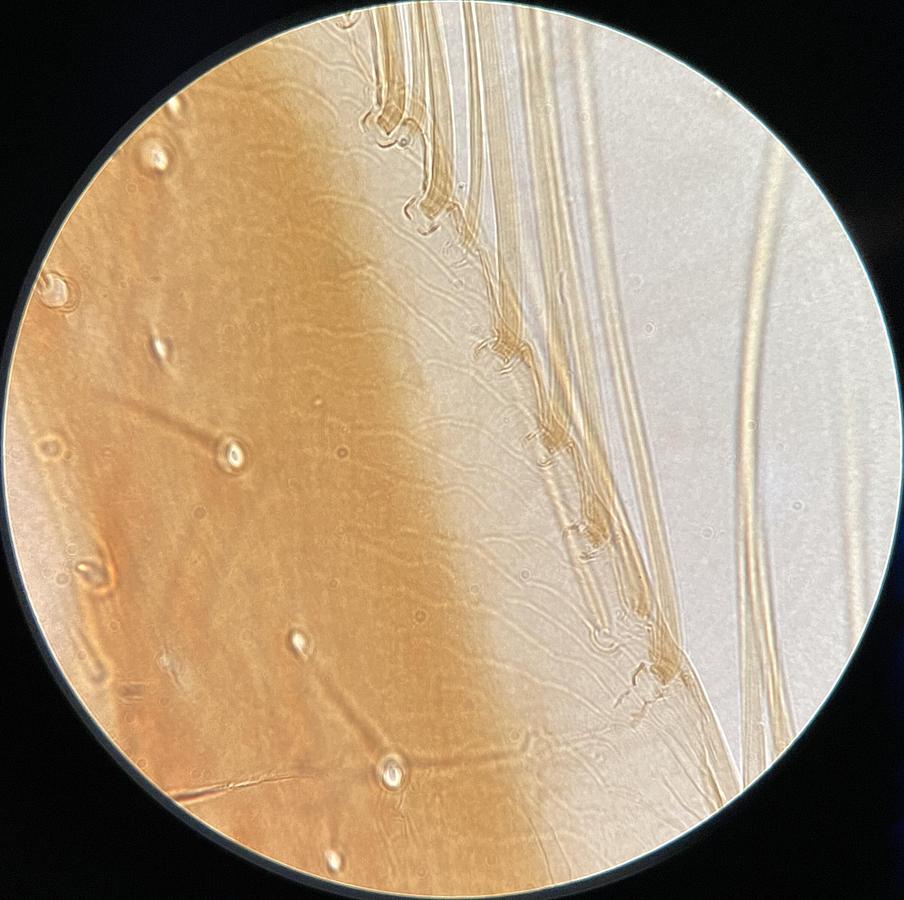Used Nikon Plan APO VC 100x/1.40 Oil ∞/0.17 DIC N2 M25 Microscope Objective