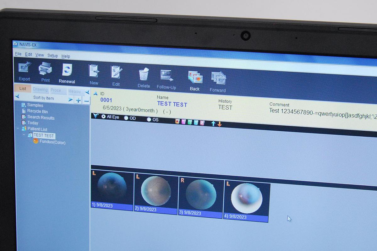 Used Nidek AFC-330 Non-Mydriatic Auto Fundus Camera W/ Case, Software, Laptop