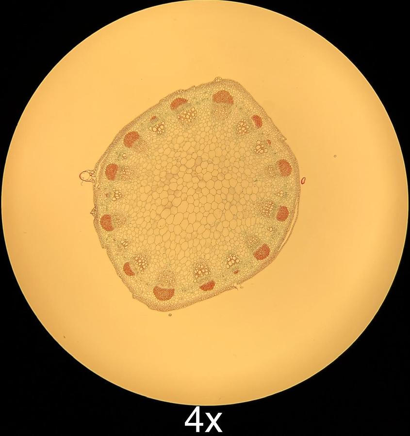 Used Motic BA400 Trinocular Phase Contrast Microscope W/ 4/10/20/40/100 Objectives