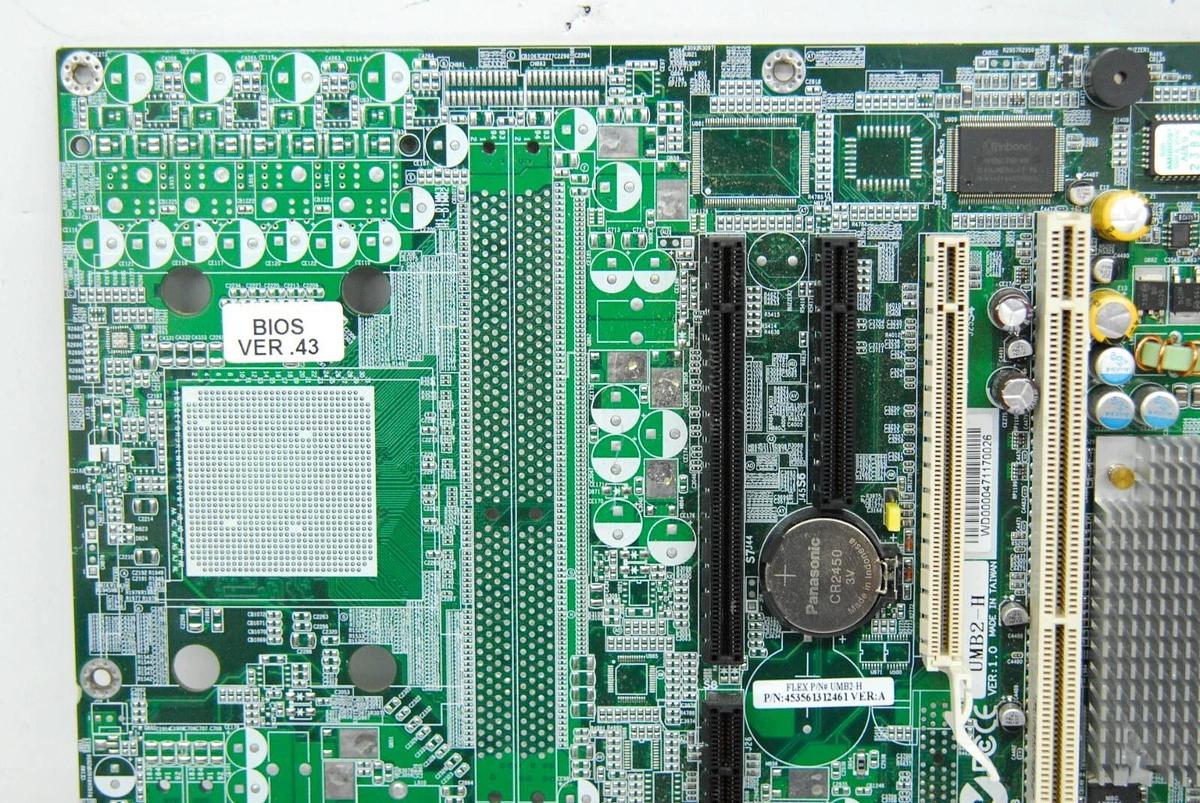 Used Philips 453561312461 UMB2-H Motherboard (iU22/iE33 Ultrasound)