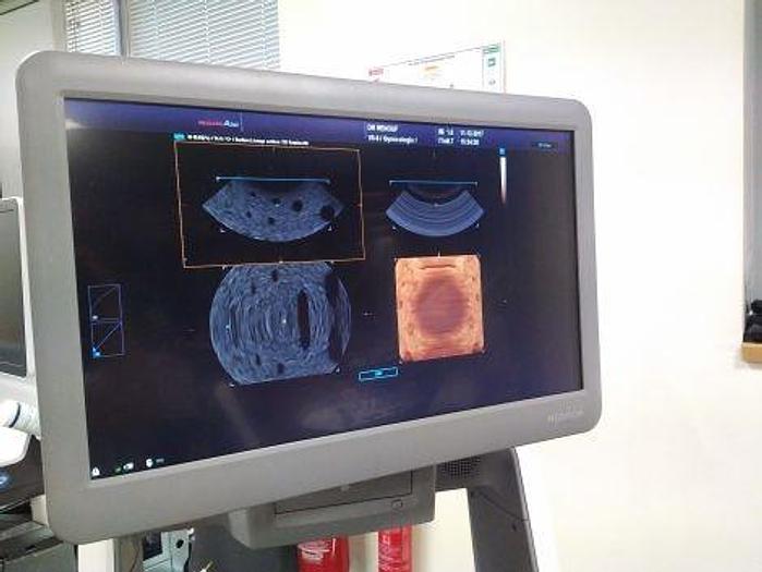 Used SAMSUNG MEDISON Accuvix A30 OB / GYN - Vascular Ultrasound