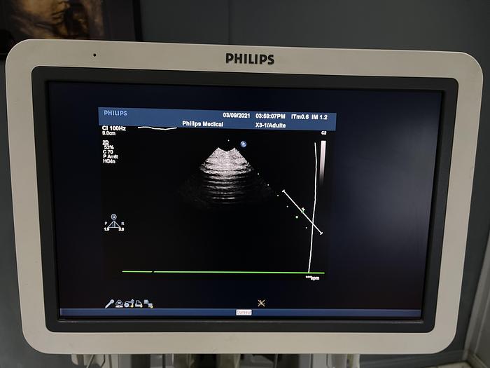Gebraucht Philips IE33 Ultraschallgerät mit 4 Ultraschallsonden, Sony Drucker