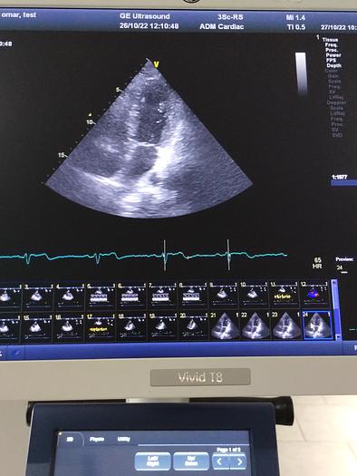 Gebraucht GE Vivid T8