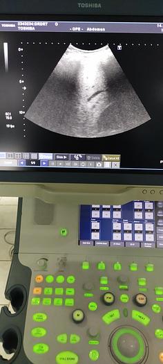 Gebraucht Toshiba PVT-375BT konvex Ultraschallsonde