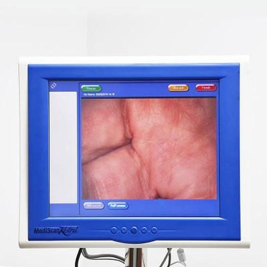 D'occasion COLPOSCOPE VIDEO KAPPA GERMANY