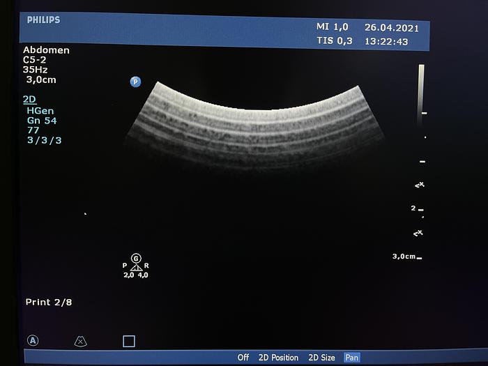 Gebraucht PHILIPS probe C5-2