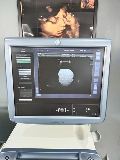Gebraucht GE Voluson E8 Expert Ultraschallgerät mit RAB4-8-D Sonde und DVD Brenner SW: BT13