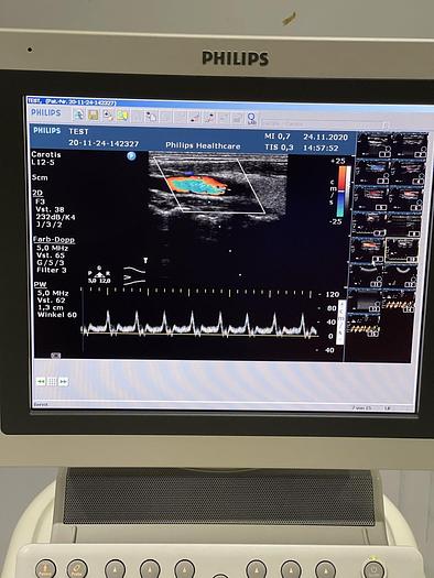 Gebraucht Philips HD 11 XE Ultraschallgerät mit 5x Sonden