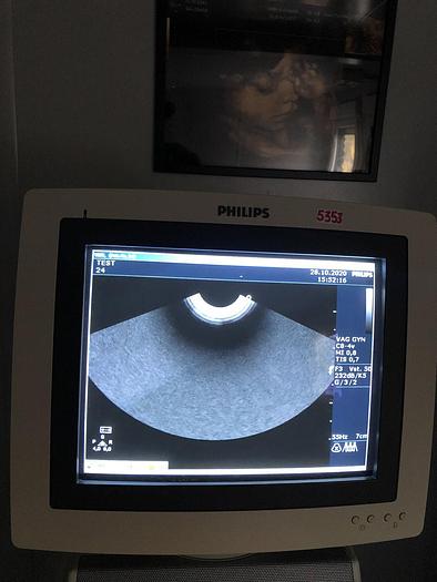 Gebraucht Philips HD11 Ultraschallgerät mit 3x Sonden, Sony Drucker UP-D895MD