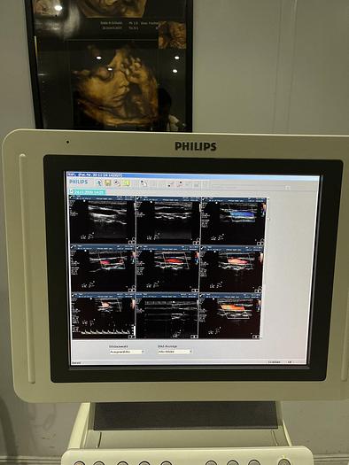 Gebraucht Philips HD 11 XE Ultraschallgerät mit 5x Sonden