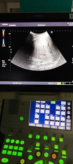 Gebraucht Toshiba PVT-375 Konvex Ultraschallsonde