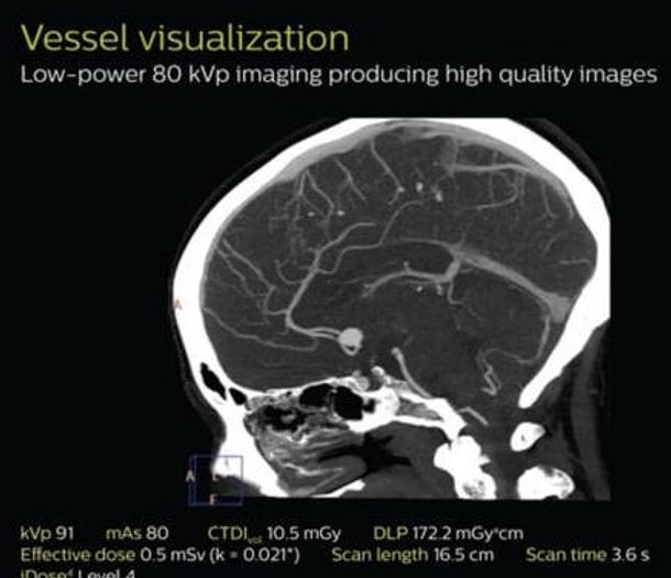 Usado Resonancia Magnética PHILIPS Achieva TX 3.0T