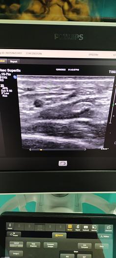 Gebraucht  Philips L15-7io Ultraschallsonde