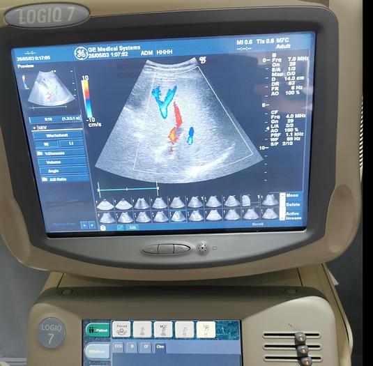Gebraucht GE Logiq 7 Ultraschallgerät mit Sony Drucker UP-895MDW