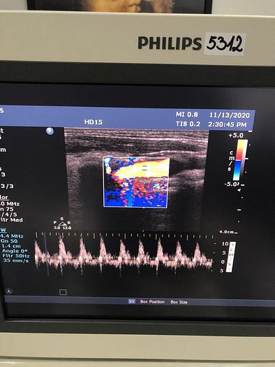 Gebraucht Philips HD15 Ultraschallgerät mit 3 Sonden und Drucker