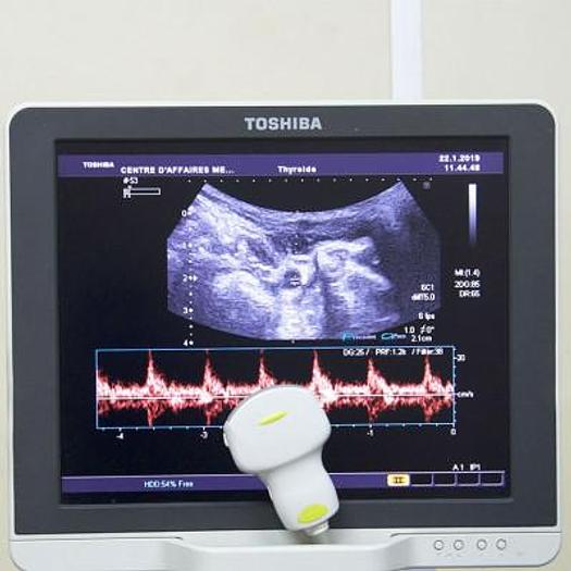 D'occasion ECHOGRAPHE TOSHIBA XARIO COULEUR DOPPLER AVEC 3 SONDES ET ÉCRAN PLAT