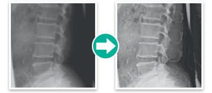 2020 FujiFilm FCR PRIMA T2