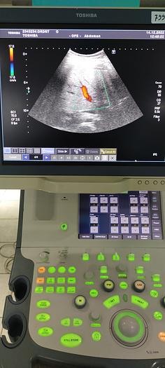 Gebraucht Toshiba PVT-375BT konvex Ultraschallsonde