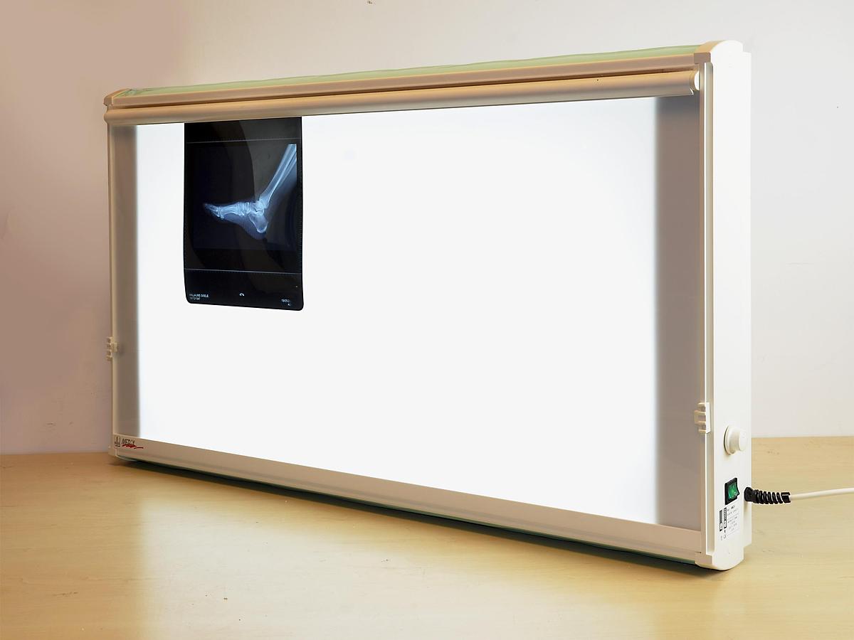 Neuf NEGATOSCOPE ELLA MED'X 1 PLAGE