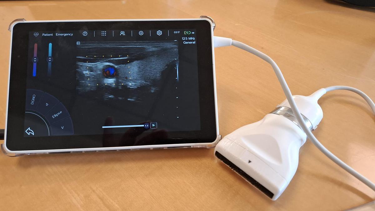 D'occasion ECHOGRAPHE SUPER PORTABLE SONOSCANNER U-LITE PRO 