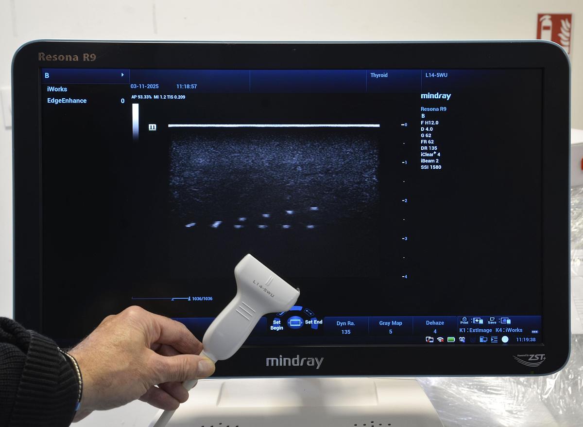 D'occasion ECHOGRAPHE MINDRAY RESONA R9