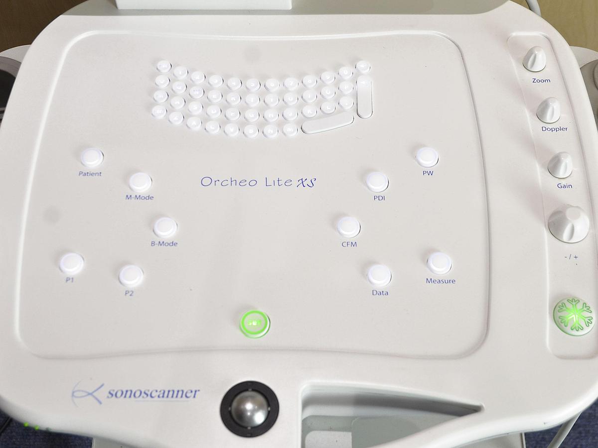 D'occasion ECHOGRAPHE SONOSCANNER ORCHEO LITE PORTABLE