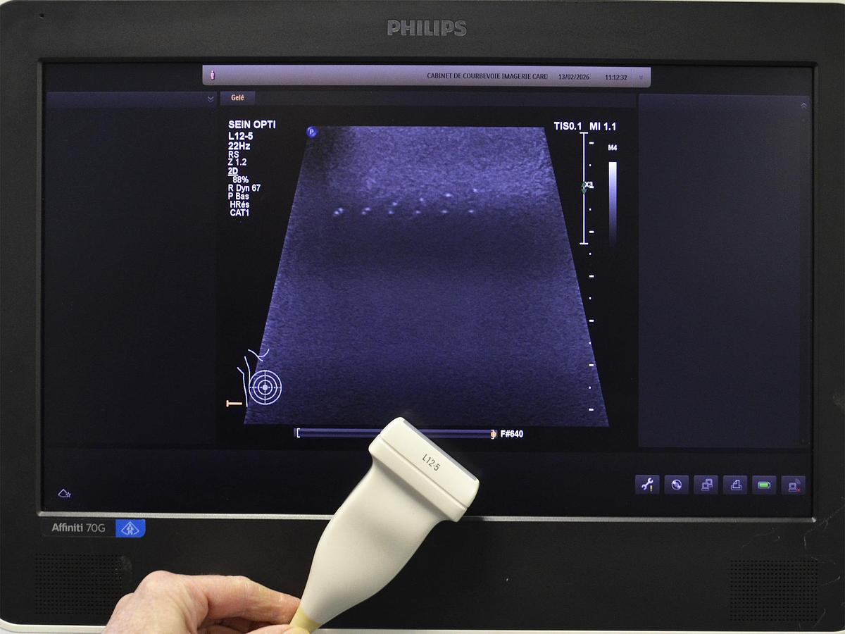 D'occasion ECHOGRAPHE PHILIPS AFFINITI 70G