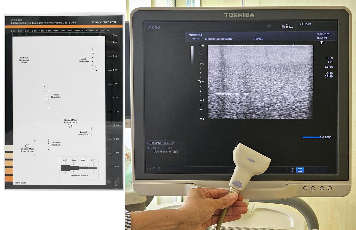 D'occasion ECHOGRAPHE TOSHIBA APLIO 400