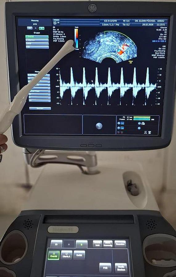 D'occasion ECHOGRAPHE  GENERAL ELECTRIC VOLUSON E6