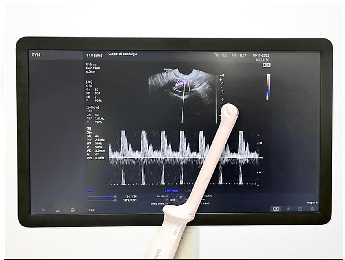 D'occasion ECHOGRAPHE SAMSUNG HS50 